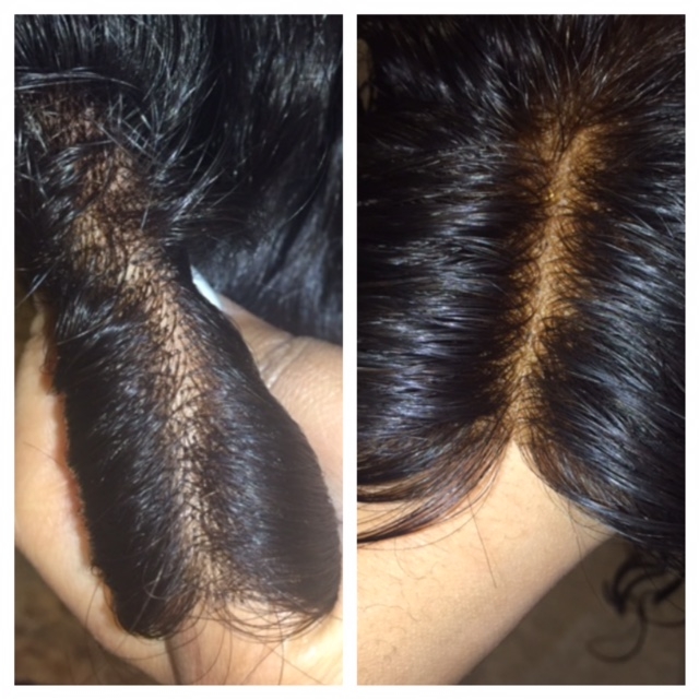 What are bleached knots and do I need them on my lace wig?